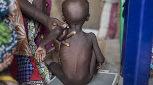 shocking implications of child malnutrition